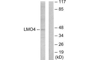 Western blot analysis of extracts from 293 cells, using LMO4 antibody.