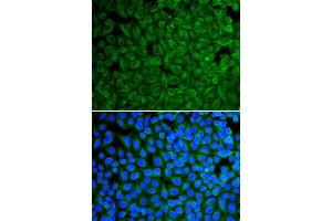 Immunofluorescence analysis of A549 cell using GAD2 antibody. (GAD65 Antikörper  (AA 401-585))