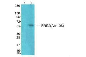 Western blot analysis of extracts from 293 cells (Lane 2), using FRS2 (Ab-196) antiobdy. (FRS2 Antikörper  (Tyr196))