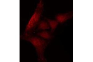 ABIN6266579 at 1/100 staining HepG2 cells by IF/ICC.