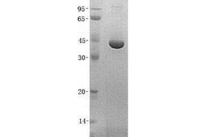 Validation with Western Blot (UROD Protein (His tag))