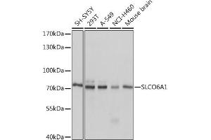 Western blot analysis of extracts of various cell lines, using SLCO6 Rabbit pAb (4963) at 1:1000 dilution. (SLCO6A1 Antikörper  (AA 480-580))