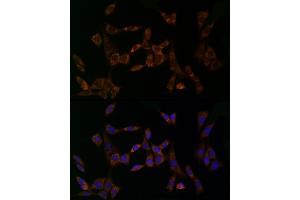 Immunofluorescence analysis of NIH/3T3 cells using MDK Rabbit pAb (ABIN3020790, ABIN3020791, ABIN3020792 and ABIN6213725) at dilution of 1:25 (40x lens). (Midkine Antikörper  (AA 21-143))