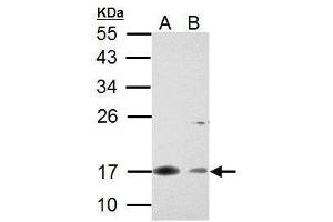 Western Blotting (WB) image for anti-Baculoviral IAP Repeat-Containing 5 (BIRC5) (C-Term) antibody (ABIN2857039)