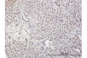 Image no. 3 for anti-Myeloid Leukemia Factor 2 (MLF2) (AA 1-249) antibody (ABIN599027) (MLF2 Antikörper  (AA 1-249))