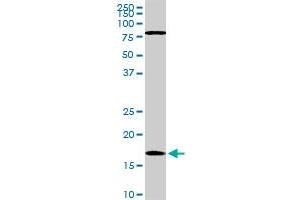 Western Blotting (WB) image for anti-Cofilin 1 (CFL1) (AA 1-167) antibody (ABIN598606) (Cofilin Antikörper  (AA 1-167))
