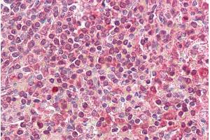 Immunohistochemistry (IHC) image for anti-Major Histocompatibility Complex, Class II, DQ alpha 2 (HLA-DQA2) (Internal Region) antibody (ABIN570890)