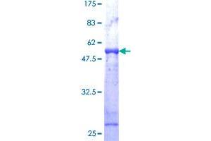 VAPB Protein (AA 1-243) (GST tag)