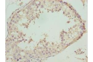 Immunohistochemistry of paraffin-embedded human testis tissue using ABIN7161250 at dilution of 1:100 (NBPF3 Antikörper  (AA 1-252))