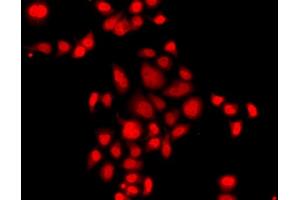 Immunofluorescence analysis of  cells using MLF1 antibody (ABIN6128238, ABIN6143875, ABIN6143877 and ABIN6224035). (MLF1 Antikörper  (AA 1-268))