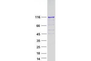 Western Blotting (WB) image for Histone Deacetylase 7 (HDAC7) (Transcript Variant 1) protein (Myc-DYKDDDDK Tag) (ABIN2722519)