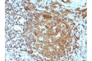 Formalin-fixed, paraffin-embedded human Tonsil stained with CD45RA Mouse Monoclonal Antibody (PTPRC/818). (CD45 Antikörper)