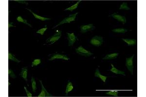 Immunofluorescence of monoclonal antibody to RNF2 on HeLa cell.