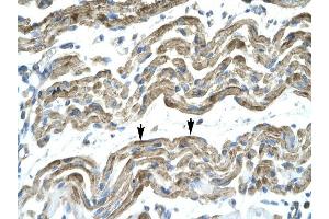C13ORF8 antibody was used for immunohistochemistry at a concentration of 4-8 ug/ml to stain Skeletal muscle cells (arrows] in Human Muscle. (ZNF828 Antikörper  (Middle Region))