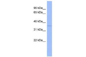 WB Suggested Anti-WNT5B Antibody Titration:  0. (WNT5B Antikörper  (Middle Region))