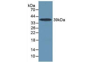 Detection of Recombinant IL17RA, Mouse using Polyclonal Antibody to Interleukin 17 Receptor A (IL17RA) (IL17RA Antikörper  (AA 590-848))