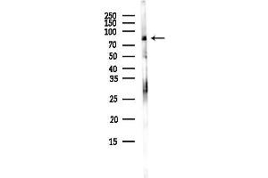 anti-Calpain 8 (CAPN8) antibody
