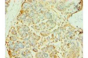 Immunohistochemistry of paraffin-embedded human pancreatic tissue using ABIN7145070 at dilution of 1:100 (COQ8A Antikörper  (AA 1-220))