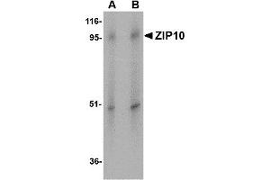 Western Blotting (WB) image for anti-Solute Carrier Family 39 (Zinc Transporter), Member 10 (SLC39A10) (Middle Region) antibody (ABIN1031175) (SLC39A10 Antikörper  (Middle Region))