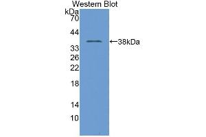 Western blot analysis of the recombinant protein. (TNP1 Antikörper  (AA 3-53))