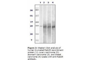 Image no. 2 for anti-RAB25, Member RAS Oncogene Family (RAB25) antibody (ABIN207613) (RAB25 Antikörper)