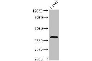 Western Blot Positive WB detected in: Rat liver tissue All lanes: ETV7 antibody at 3 μg/mL Secondary Goat polyclonal to rabbit IgG at 1/50000 dilution Predicted band size: 39, 33, 31, 37, 30, 23 kDa Observed band size: 39 kDa (ETV7 Antikörper  (AA 134-218))