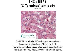 Image no. 2 for anti-Retinol Binding Protein 1, Cellular (RBP1) (C-Term) antibody (ABIN1738770) (RBP1 Antikörper  (C-Term))