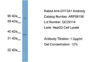 WB Suggested Anti-GTF2A1  Antibody Titration: 0. (GTF2A1 Antikörper  (Middle Region))
