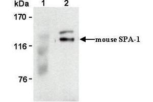 Western Blotting (WB) image for anti-Signal-Induced Proliferation-Associated 1 (SIPA1) antibody (ABIN1449260)