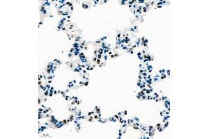 Immunohistochemistry of paraffin embedded rat lung using UBE3A (ABIN7076104) at dilution of 1:1000 (400x lens) (ube3a Antikörper)