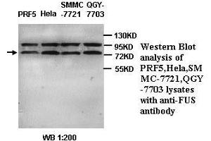 Image no. 1 for anti-Fused in Sarcoma (FUS) (C-Term) antibody (ABIN791042) (FUS Antikörper  (C-Term))