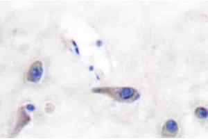 Immunohistochemistry (IHC)analyzes of MARCKS antibody in paraffin-embedded human brain tissue. (MARCKS Antikörper)