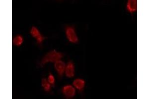ABIN6277380 staining Hela by IF/ICC. (KISS1R Antikörper  (C-Term))