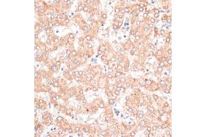 Immunohistochemistry of paraffin-embedded human liver using ABCB7 antibody (ABIN6291732) at dilution of 1:100 (40x lens). (ABCB7 Antikörper)