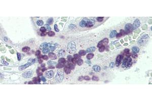 Immunohistochemistry (IHC) image for anti-PR Domain Containing 9 (PRDM9) (Middle Region) antibody (ABIN2774963)