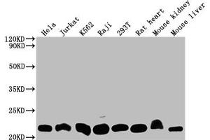 Western Blot Positive WB detected in: Hela whole cell lysate, Jurkat whole cell lysate, K562 whole cell lysate, Raji whole cell lysate, 293T whole cell lysate, Rat heart tissue, Mouse kidney tissue, Mouse liver tissue All lanes: DHFR antibody at 1:2000 Secondary Goat polyclonal to rabbit IgG at 1/50000 dilution Predicted band size: 22, 16 kDa Observed band size: 22 kDa (Rekombinanter Dihydrofolate Reductase Antikörper)