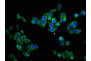 Immunofluorescence staining of PC-3 cells with ABIN7160347 at 1:133, counter-stained with DAPI. (CHRM3 Antikörper  (AA 253-492))