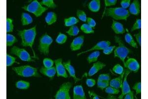IF analysis of ACADM/MCAD using anti-ACADM/MCAD antibody (ABIN7601543). (Medium-Chain Specific Acyl-CoA Dehydrogenase, Mitochondrial (MCAD) (AA 38-401) Antikörper)