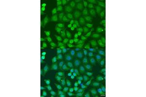Immunofluorescence analysis of U2OS cells using ZFYVE16 antibody (ABIN6129169, ABIN6150439, ABIN6150441 and ABIN6223717) at dilution of 1:100. (ZFYVE16 Antikörper  (AA 1-280))