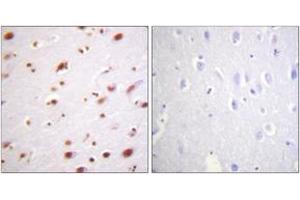 Immunohistochemistry analysis of paraffin-embedded human brain, using Catenin-delta1 (Phospho-Tyr228) Antibody. (CTNND1 Antikörper  (pTyr228))