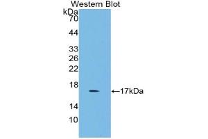 Western blot analysis of the recombinant protein. (GDF3 Antikörper  (AA 253-366))