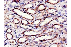 Immunohistochemistry of paraffin-embedded human kidney tissue using ABIN7152982 at dilution of 1:100 (FAK Antikörper  (AA 363-464))