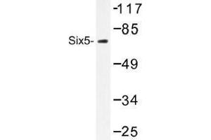 Image no. 1 for anti-Homeobox protein SIX5 (SIX5) antibody (ABIN317916) (Six5 Antikörper)