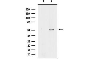 anti-Nuclear Prelamin A Recognition Factor (NARF) (C-Term) antibody