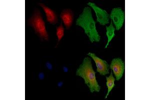 ABIN6258462 and ABIN6273867 staining  cells by IF/ICC. (GPER Antikörper  (C-Term))