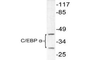 Image no. 1 for anti-CCAAT/enhancer Binding Protein (C/EBP), alpha (CEBPA) antibody (ABIN271872) (CEBPA Antikörper)