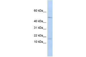 WB Suggested Anti-VPREB1 Antibody Titration:  0. (VPREB1 Antikörper  (Middle Region))