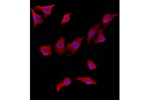 ABIN6263142 and ABIN6272924 staining HepG2 by IF/ICC. (MAT2B Antikörper  (Internal Region))