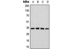 Western blot analysis of Cathepsin H expression in Jurkat (A), K562 (B), mouse kidney (C), PC12 (D) whole cell lysates. (Cathepsin H Antikörper  (Center))