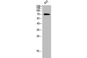 Western Blot analysis of 823 cells using Phospho-PKC ζ (T410) Polyclonal Antibody (PKC zeta Antikörper  (pThr410))